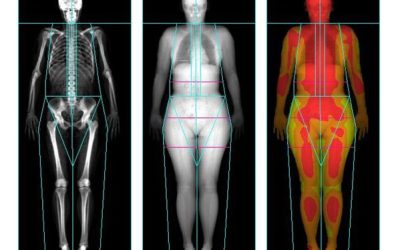 PESO Y COMPOSICIÓN CORPORAL